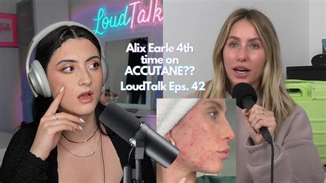 alix earle before accutane|Dermatologist Reacts to Accutane Journey from Alix Earle